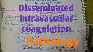 Disseminated Intravascular Coagulation DIC Pathology [upl. by Gabriello]