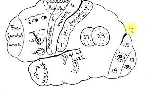 speech  aphasia  dysarthria [upl. by Minne]