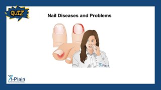 Nail Diseases and Problems  Quiz [upl. by Chu319]