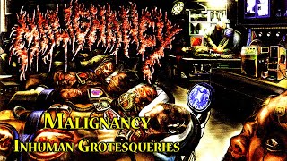 Malignancy  Inhuman Grotesqueries [upl. by Nymsaj]