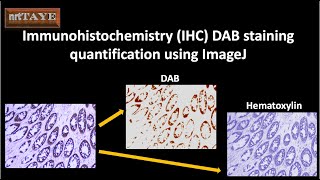 Immunohistochemistry IHC DAB staining quantification using ImageJ [upl. by Goines]