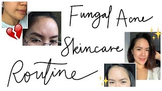 MALASSEZIA FOLLICULITISFUNGAL ACNE Tiny Forehead Bumps  My Skincare Routine  jskavee [upl. by Nnalyrehs994]