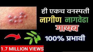 नागीण’ रोग का होतो नागीण रोग घरगुती उपाय Home Remedies For Nagin Disease In Marathi  Shingles [upl. by Htomit]