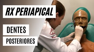 Como radiografar dentes posteriores com posicionador  Técnica periapical [upl. by Ala]