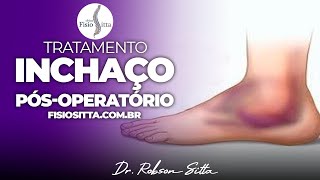 EDEMA INCHAÇO PÓS TRAUMA FRATURA IMOBILIZAÇÃO CONTUSÃO Clínica de Fisioterapia Dr Robson Sitta [upl. by Dorothy260]