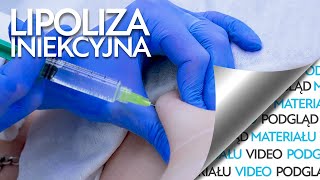 Zabieg wyszczuplający czyli lipoliza iniekcyjna [upl. by Yenaj]