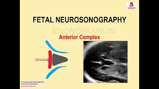 Fetal Neurosonography – Anterior Complex [upl. by Pascha861]