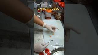 Lymph nodes excision biopsy sample நிணநீர் முனைகள்  lymphnodes biopsy nodes histopathology [upl. by Kaiser]