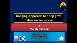 thalamic lesions [upl. by Olwen636]