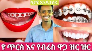 የጥርስ እና የብሬስ ዋጋ ዝር ዝር Clinic For The Best Teeth And Braces Price List In Ethiopia [upl. by Ainnek]