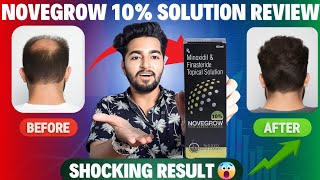 Novegrow 10 Minoxidil Solution Review  Minoxidil Finasteride Solution Added With Capixyl [upl. by Ainirtak]