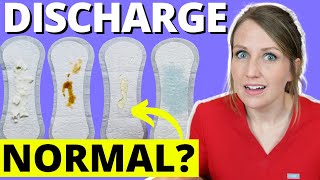 Doctor Answers Top 5 Discharge Questions [upl. by Merrel]