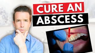 Dentist Explains a Tooth Abscess  How to Cure an Abscess Tooth [upl. by Brozak]