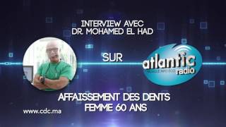 Affaissement des dents [upl. by Spanjian]