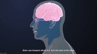 Transport of βamyloid from brain to eye causes retinal degeneration in Alzheimer’s disease [upl. by Murrell320]