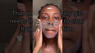 How to fade hyperpigmentation FAST [upl. by Notnirb]