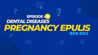 Pregnancy Epulis  Dental Diseases  Episode  01 BDS Edu [upl. by Hanikehs]