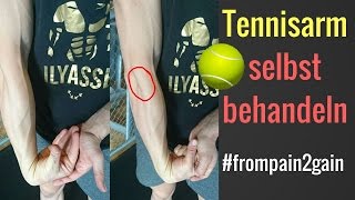 Tennisarm  Tennisellenbogen selbst behandeln  3 Methoden die funktionieren│Mischa Kotlyar [upl. by Nairim]