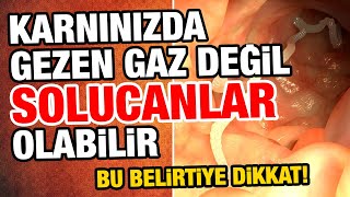 Bağırsak kurtlarını döken etkili çözüm Bağırsak nasıl temizlenir Bağırsak kurdu nasıl dökülür [upl. by Colwen]