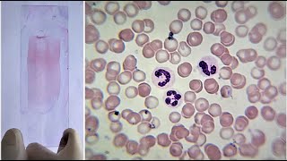 Blood Smear Preparation and Staining Practical Lab [upl. by Igiul355]