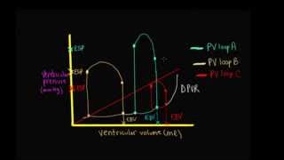 Schneid Guide to Comparison of Different PV Loops [upl. by Docile]