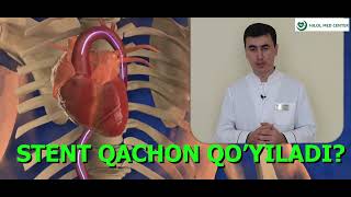 QACHON STENT QOYILADI ҚАЧОН СТЕНТ ҚЎЙИЛАДИ [upl. by Bremen]