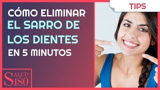 Cómo eliminar el sarro de los dientes en 5 minutos  Salud180 [upl. by Lalat]