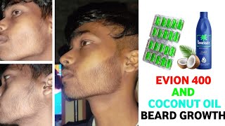 Evion 400 for beard growthevion 400 and coconut oil for beard growthhow to use evion 400 for beard [upl. by Hazrit]