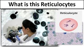 Reticulocytes [upl. by Gary]