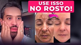 MÁGICA NA PELE Receita POTENTE MELHOR QUE BOTOX Remove MANCHAS DA PELE muito RÁPIDO [upl. by Nelyk]