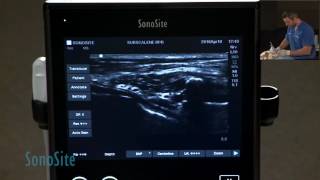 Ultrasound Guided Brachial Plexus Nerve Block in a Dog Part 3 of 3 [upl. by Egas]