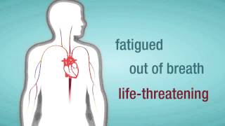 Valve Regurgitation When a Heart Valve Leaks [upl. by Adine]