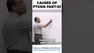 Causes Of Ptosis Part 01 drnajeeblectures drnajeeb shortvideo [upl. by Samanthia]