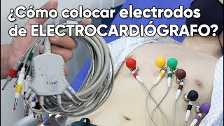 ¿Cómo colocar los electrodos de un electrocardiógrafo [upl. by Narual252]