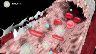 Development of atherosclerosis [upl. by Anyal]