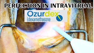 How to give intravitreal Ozurdex  Exercise right protocols from the beginning [upl. by Kassaraba]