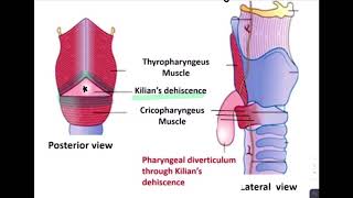 ESOPHAGEAL DIVERTICULUM [upl. by Titos]