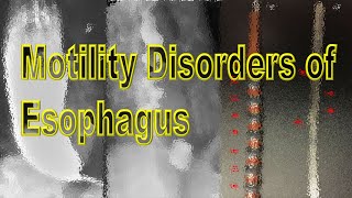 Motility Disorders of Esophagus [upl. by Arondell]