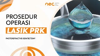 Prosedur Operasi Lasik PRK Photorefractive Keratectomy di National Eye Center [upl. by Tiena935]