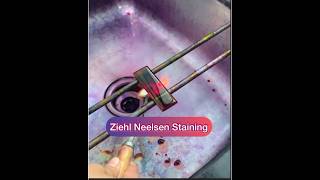 Ziehl Neelsen stainingZN stainingAFB staining Afb tb znstain [upl. by Ahsei425]