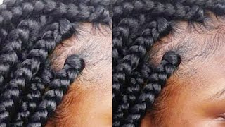 Tips and Tricks Gripping The Roots Rubber Band MethodBox Braid Like A Pro part 4 [upl. by Tertias]