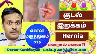 குடல் இறக்கம் அறிகுறி சரி செய்வது எப்படிhernia symptoms exercise treatment at homedr karthikeyan [upl. by Nirro]