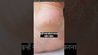 इन लक्षणों को कभी ना कभी नजरअंदाज drrobin facts health food ayurved doctor remedy food [upl. by Aicenra25]