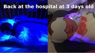 High Bilirubin Emergency amp Hospital stay with a 3 day old [upl. by Reahard]