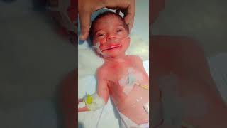 Preterm baby❤️newbornbaby cute subscribe baby trending shorts youtubeshorts viralvideo yt [upl. by Jamie]