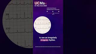 ECG Multifocal Atrial Tachycardia [upl. by Enelehcim]