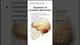 Symptoms of cerebellar dysfunction [upl. by Adnawyek6]