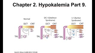 Hypokalemia Part 9 Case Studies [upl. by Coffeng103]