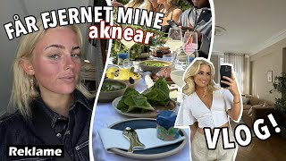 VLOG EN DAG MED MIG Fjernelse af aknear fashion haul amp filmpremiere [upl. by Erik]