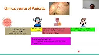 240515 Varicella Zoster virus  Treatment and prevention [upl. by Maurita]